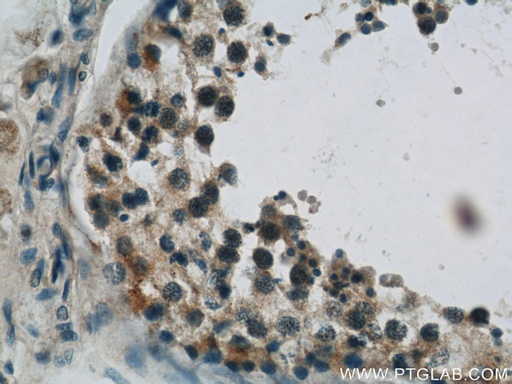[22124-1-AP-20UL] TBC1D1 Polyclonal antibody