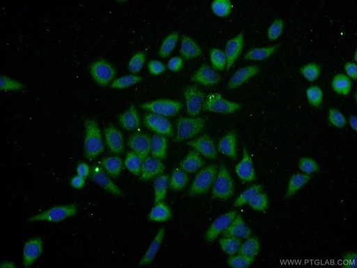 [22126-1-AP-150UL] Ubiquilin 1 Polyclonal antibody