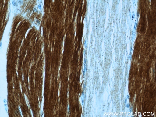 [22130-1-AP-20UL] TNNI2 Polyclonal antibody