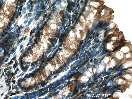 [22136-1-AP-20UL] TIGAR Polyclonal antibody