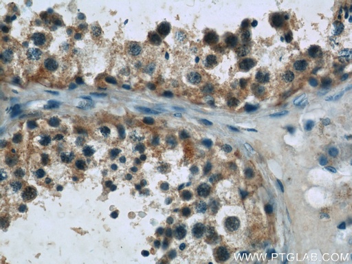 [22137-1-AP-20UL] DAND5 Polyclonal antibody