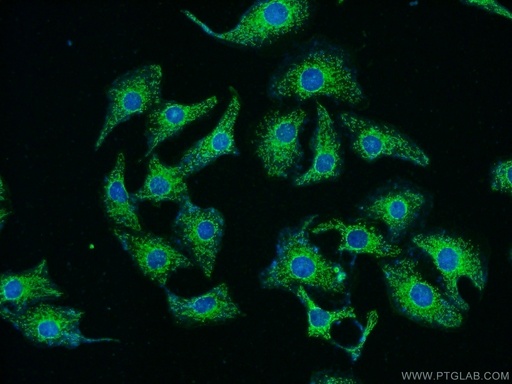 [22138-1-AP-150UL] RYK Polyclonal antibody