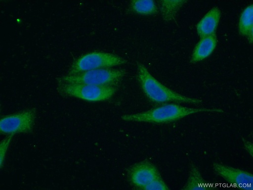 [22140-1-AP-20UL] RASAL2 Polyclonal antibody