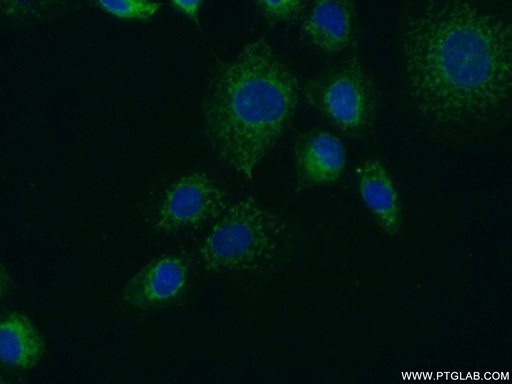 [22141-1-AP-20UL] FUT4 Polyclonal antibody
