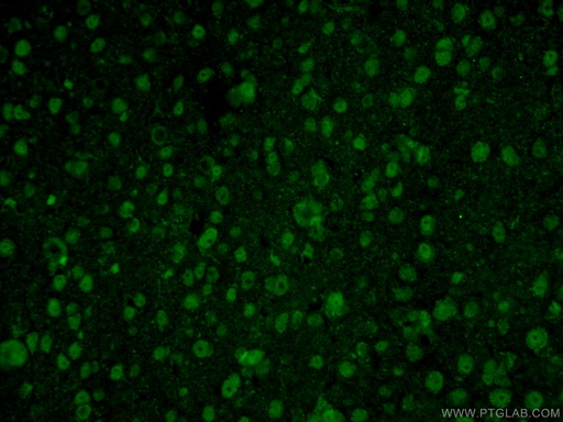 [22142-1-AP-150UL] RCC1 Polyclonal antibody