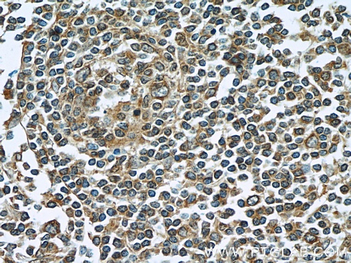 [22144-1-AP-150UL] LY6E Polyclonal antibody