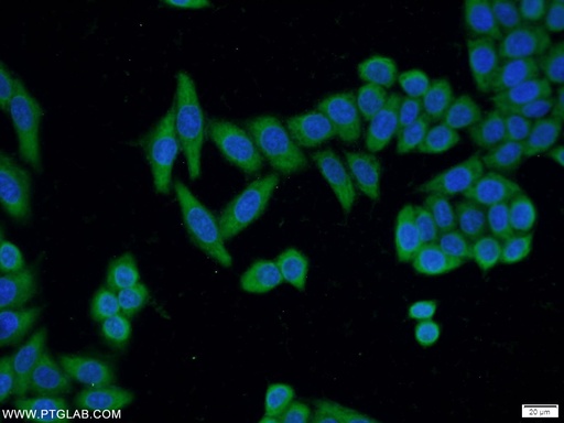 [22147-1-AP-20UL] ADAM5 Polyclonal antibody