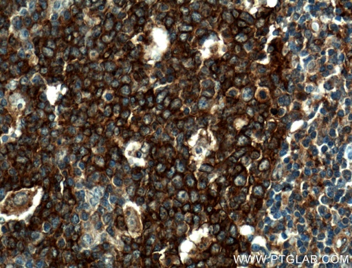 [22151-1-AP-20UL] TRIM72 Polyclonal antibody