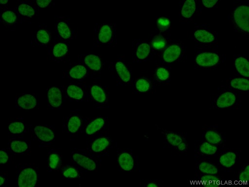 [22156-1-AP-150UL] YY1 Polyclonal antibody