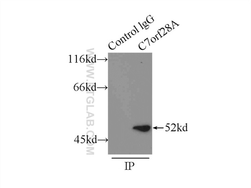 [22159-1-AP-20UL] CCZ1 Polyclonal antibody