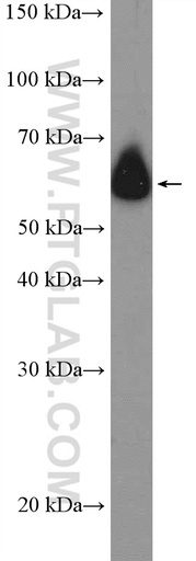 [22161-1-AP-150UL] ZNF154 Polyclonal antibody