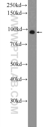 [22162-1-AP-20UL] ZNF287 Polyclonal antibody