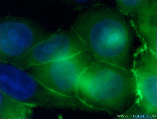 [22167-1-AP-150UL] IQGAP1 Polyclonal antibody