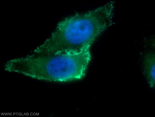 [22183-1-AP-20UL] ARHGAP21 Polyclonal antibody