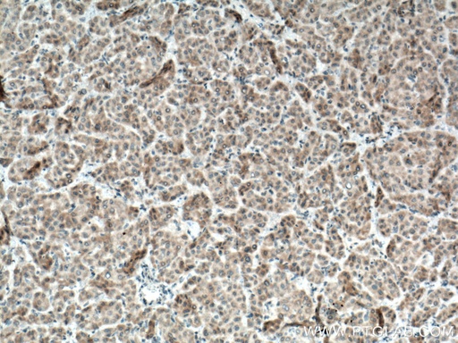 [22188-1-AP-20UL] BMP3 Polyclonal antibody