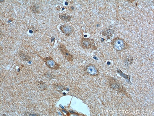 [22189-1-AP-20UL] HTR1B Polyclonal antibody