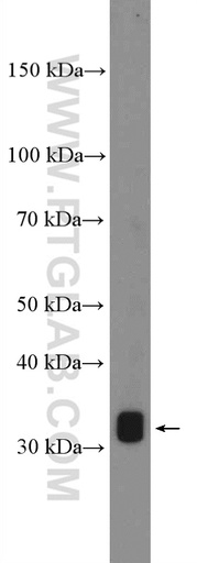 [22190-1-AP-150UL] PRB3 Polyclonal antibody