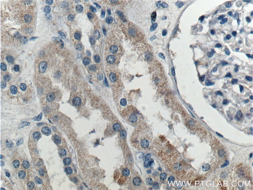 [22193-1-AP-20UL] SNX21 Polyclonal antibody