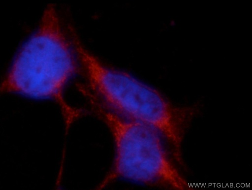 [22197-1-AP-20UL] SHISA4 Polyclonal antibody