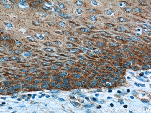 [22199-1-AP-20UL] EXPH5 Polyclonal antibody