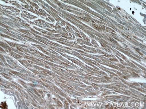 [22205-1-AP-150UL] Desmin Polyclonal antibody