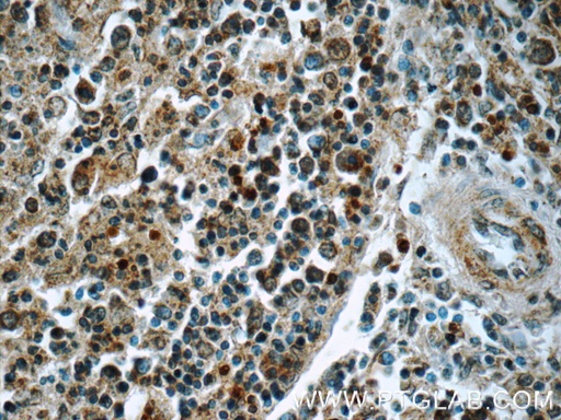 [22206-1-AP-20UL] SYK Polyclonal antibody