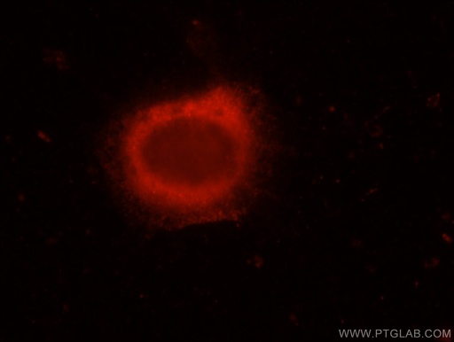 [22211-1-AP-150UL] ERC1 Polyclonal antibody