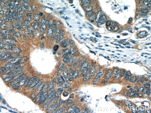 [22212-1-AP-20UL] TMF1 Polyclonal antibody