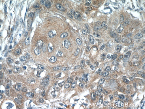 [22214-1-AP-20UL] ACP1 Polyclonal antibody