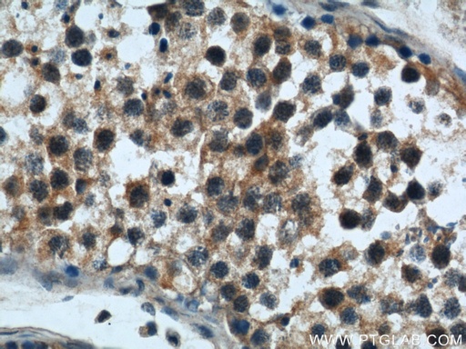 [22218-1-AP-150UL] Rabenosyn 5 Polyclonal antibody