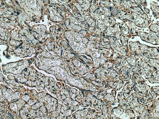 [22219-1-AP-20UL] CSE1L Polyclonal antibody