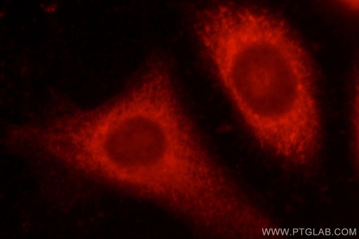 [22220-1-AP-150UL] ALDH1B1 Polyclonal antibody