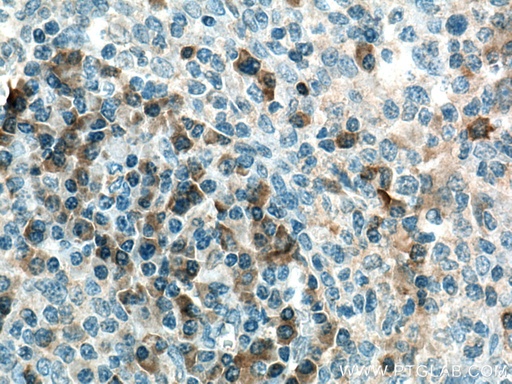 [22226-1-AP-150UL] NOS2 Polyclonal antibody