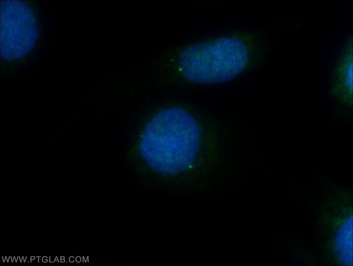 [22227-1-AP-150UL] CEP164 Polyclonal antibody