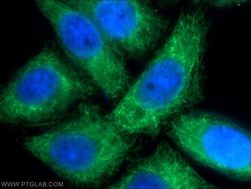 [22230-1-AP-20UL] Cytokeratin 17 Polyclonal antibody