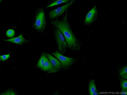 [22231-1-AP-20UL] HIP1 Polyclonal antibody