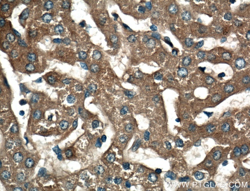 [22233-1-AP-20UL] C4 Alpha Chain/C4b/C4d Polyclonal antibody