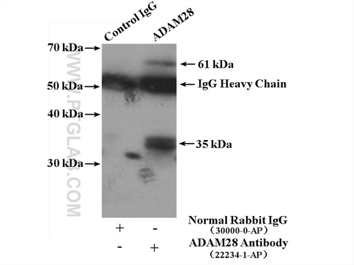 [22234-1-AP-20UL] ADAM28 Polyclonal antibody
