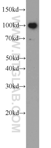 [22240-1-AP-150UL] TLR6 Polyclonal antibody