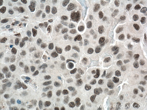 [22242-1-AP-20UL] REST Polyclonal antibody
