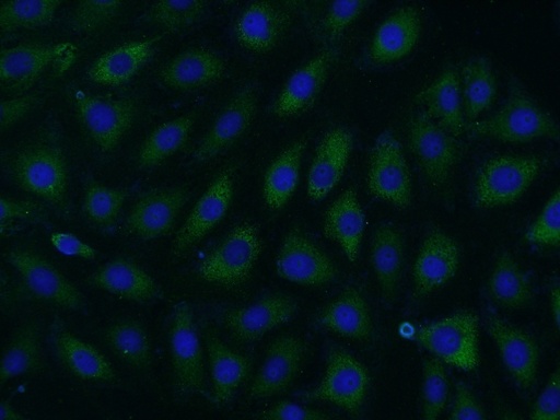 [22243-1-AP-20UL] SPOCD1 Polyclonal antibody