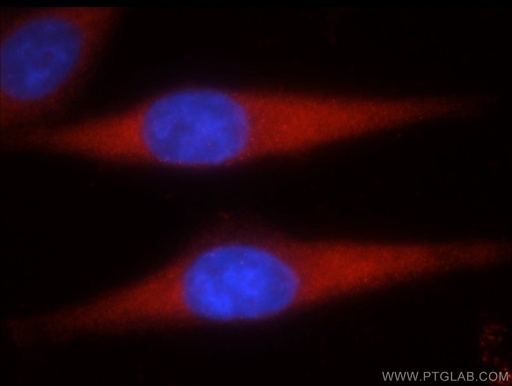 [22245-1-AP-150UL] STK4/MST1 Polyclonal antibody