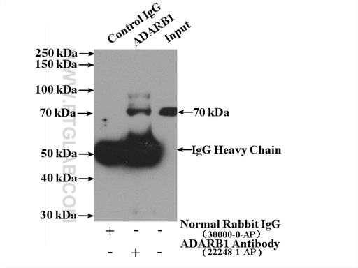 [22248-1-AP-150UL] ADARB1 Polyclonal antibody