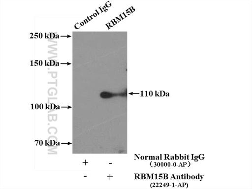 [22249-1-AP-150UL] RBM15B Polyclonal antibody