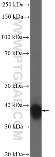 [22256-1-AP-150UL] HOXB4 Polyclonal antibody