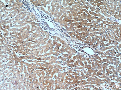 [22263-1-AP-150UL] Polycystin 1 Polyclonal antibody