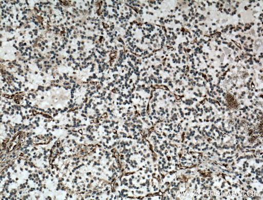 [22265-1-AP-20UL] SACS Polyclonal antibody