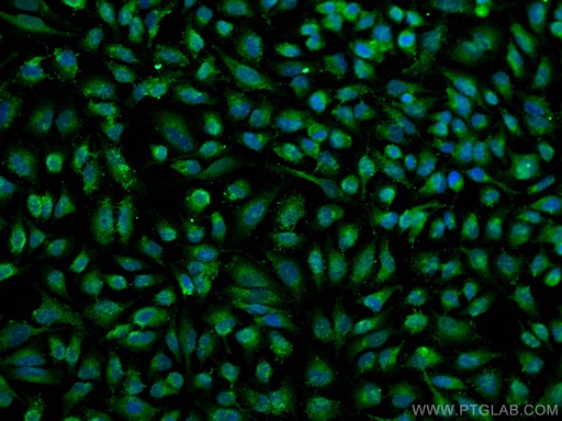 [22268-1-AP-150UL] VAMP7/TI-VAMP Polyclonal antibody