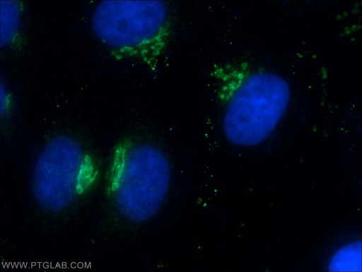 [22270-1-AP-20UL] Giantin Polyclonal antibody