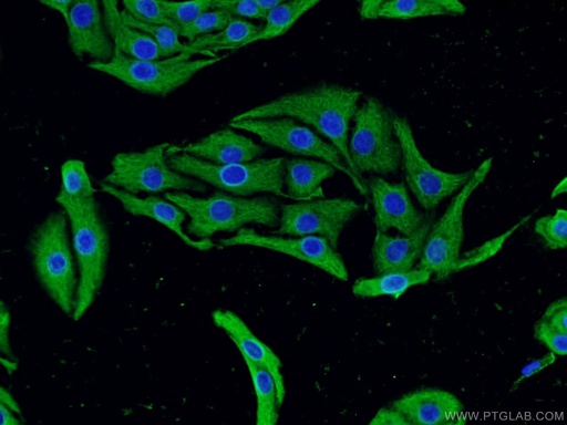 [22276-1-AP-20UL] CACNA1D Polyclonal antibody